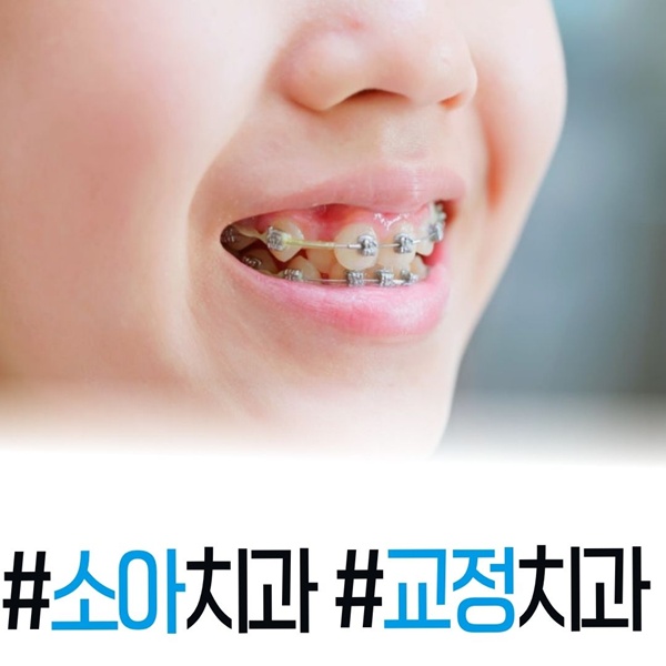 소아치과, 교정치과는 서울이건치과