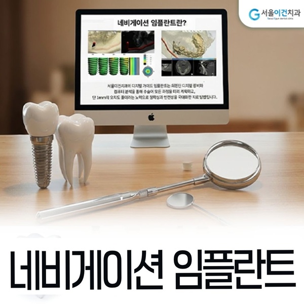 네비게이션 임플란트 진료