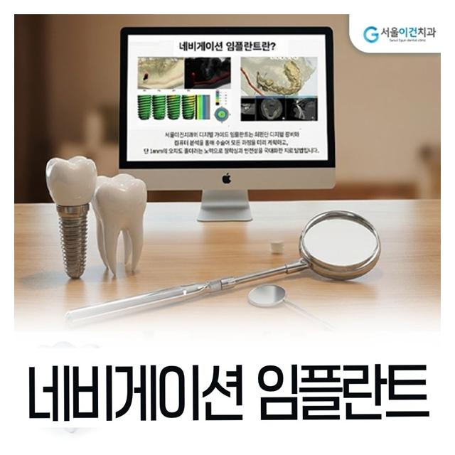 더 정교한 네비게이션 임플란트 치료로 안전하게